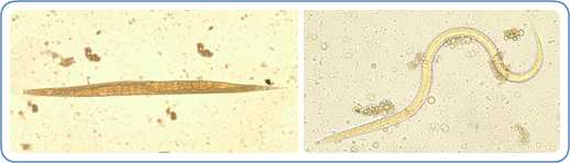 Image: Left: Adult free-living female S. stercoralis. Notice the row of eggs within the female's body. Right: Filariform (L3) larva of S. stercoralis in an unstained wet mount.