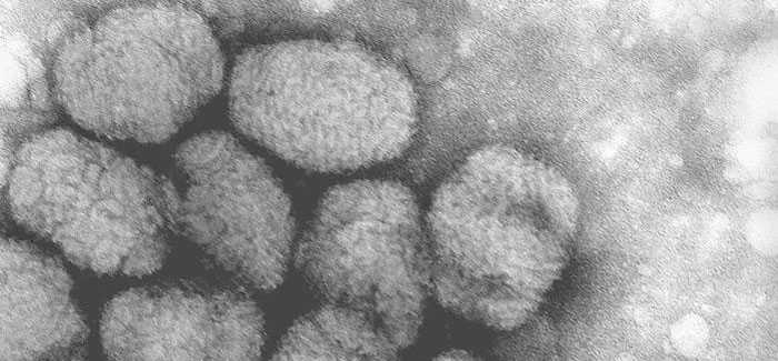 A transmission electron micrograph (TEM) of smallpox virus particles.