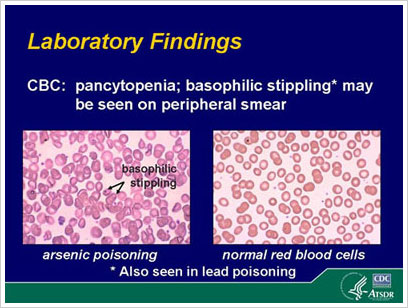 las conclusiones del laboratorio de envenenar de arsénico y glóbulos rojos normales