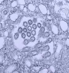 This colorized transmission electron micrograph (TEM) revealed the presence of a number of Novel H1N1 virus virions in this tissue culture sample.