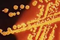 Escherichia coli bacteria grown on agar plate medium
