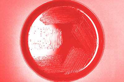 Blood agar plate culture of Haemophilus aegyptius.