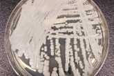 	thumbnail image of Candida auris, a fungus, growing in a petri dish