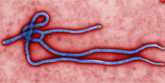 	A colorized electron micrograph of ebola virus