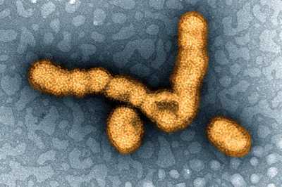 Colorized photomicrograph shows depicts a small grouping of H1N1 influenza virus particles in an orange color against a blue-gray background.