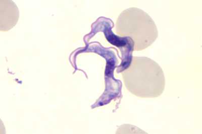 This Giemsa-stained light photomicrograph revealed the presence of two Trypanosoma brucei parasites, which were found in a blood smear. 