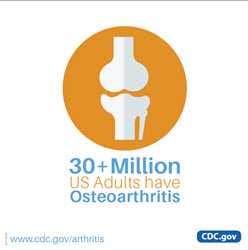 image: 30 million with osteoarthritis