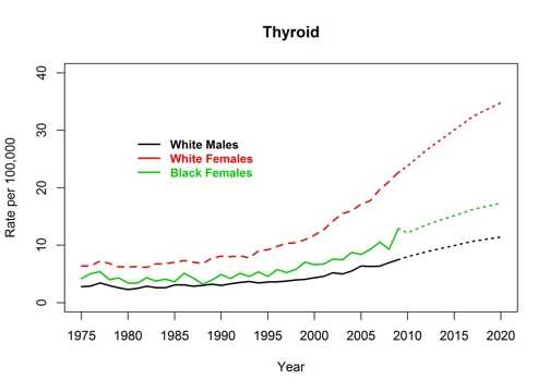 Graph showing actual and projected incidence rates for thyroid cancer by race and sex, United States, 1975 to 2020