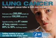 Lung cancer is the biggest cancer killer in both men and women. Every year, about 200,000 people are diagnosed and 150,000 people die. Cigarette smoking is the number 1 cause of lung cancer. It is linked to 80 to 90 percent of all lung cancers. Quitting smoking at any age can lower the risk of lung cancer.