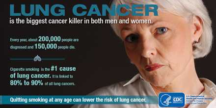 Lung cancer is the biggest cancer killer in both men and women. Every year, about 200,000 people are diagnosed and 150,000 people die. Cigarette smoking is the number 1 cause of lung cancer. It is linked to 80 to 90 percent of all lung cancers. Quitting smoking at any age can lower the risk of lung cancer.