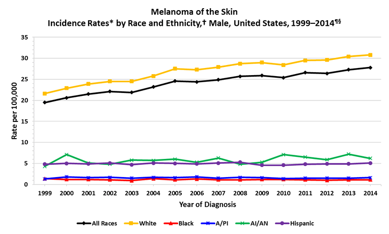 Line chart showing the changes in melanoma of the skin incidence rates for males of various races and ethnicities.