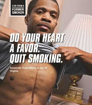 A Tip from a former smoker: Do your heart a favor. Quit smoking. Roosevelt, heart attack at age 45, Virginia.  Man showing chest scar from heart surgery.