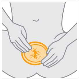 Manos colocando el cond&oacute;n femenino en su sitio para cubrir la vulva.