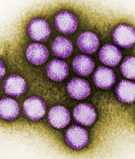 Colorized transmission electron micrograph of adenovirus