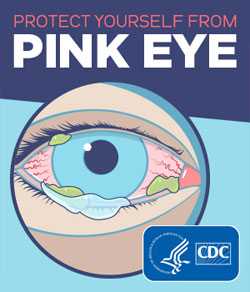 Protect yourself from pink eye.
