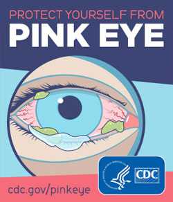 Help protect yourself from getting and spreading Pink Eye (conjunctivitis)