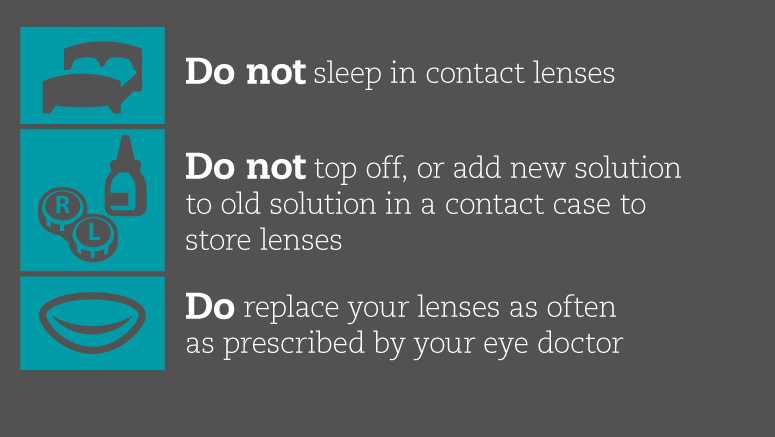 Do not sleep in contact lenses. Do not top off, or add new solution to old solution in a contact case to store lenses. Do replace your lenses as often as prescribed by your eye doctor.