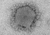 Negative stain electron microscopy shows a novel coronavirus particle with club-shaped surface projections surrounding the periphery of the particle, a characteristic feature of coronaviruses.
