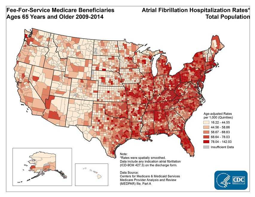 Atrial fibrillation hospitalization rates for fee-for-service Medicare beneficiaries ages 65 and older were highest in counties in the Eastern U.S. and Missouri, Arkansas, and Louisiana.