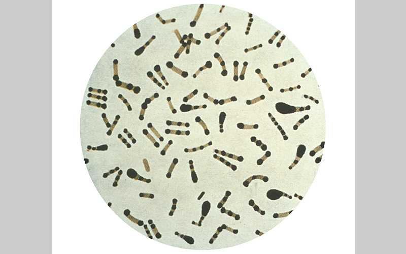 Photomicrograph of Corynebacterium diphtheriae taken from an 18 hour culture, and using Albert's stain