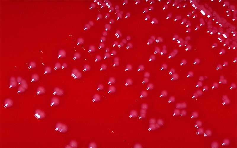Blood agar culture with growing colonies of Corynebacterium diphtheria var. belfanti bacteria