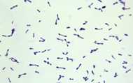 This photomicrograph shows numerous Gram-positive asporogenous, rod-shaped, Corynebacterium diphtheriae bacteria