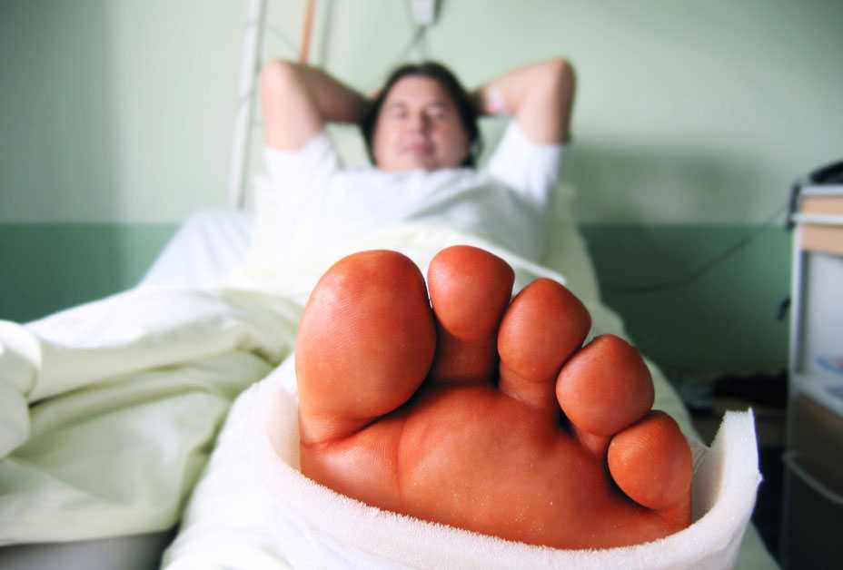 Man in hospital with swollen foot