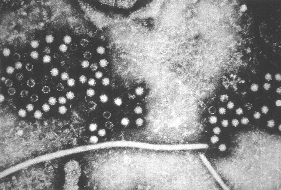Hepatitis E Micrograph