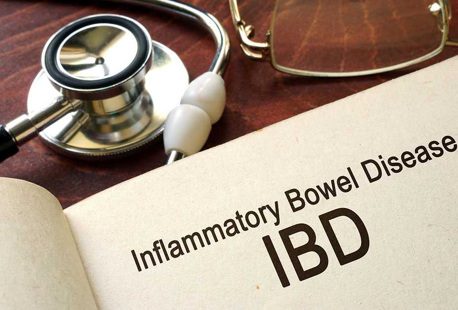 	Chart that says Inflammatory Bowel Disease