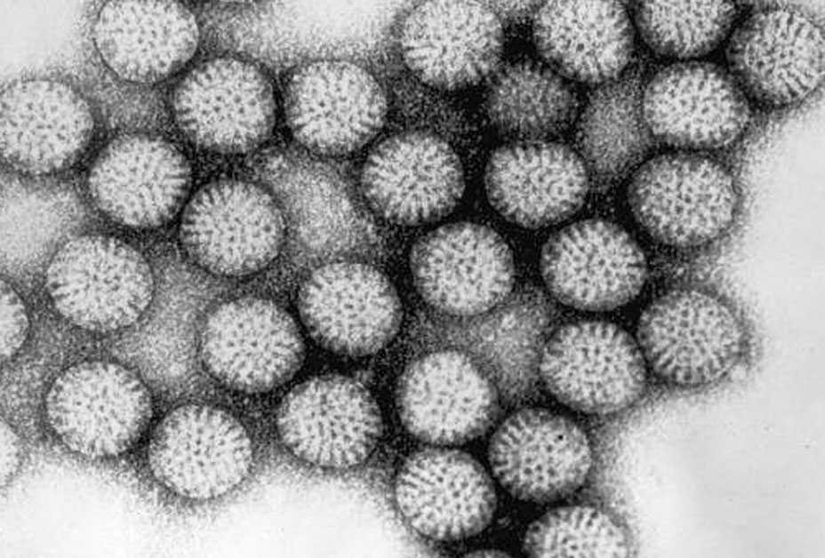 Transmisson micrograph of Rotavirus