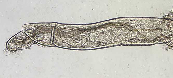 Angiostrongylus sp. male worm.