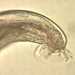 Angiostrongylus sp. male worm.