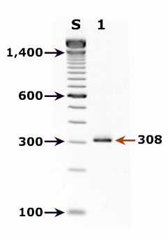 Agarose gel for a PCR diagnostic test for detection of Cyclospora DNA
