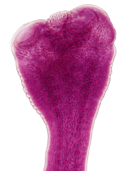 Hymenolepis nana scolex