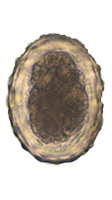 Ascaris lumbricoides fertile egg