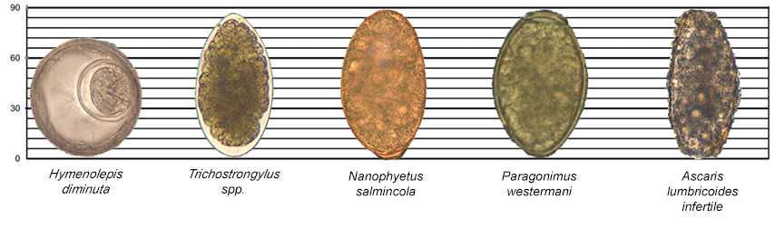 Images of Hymenolepis diminuta, Trichostrongylus spp., Nanophyetus salmincola, Paragonimus westermani, and an infertile egg of Ascaris lumbricoides along a scale for reference.