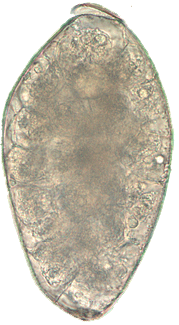 Fasciolopsis buski egg