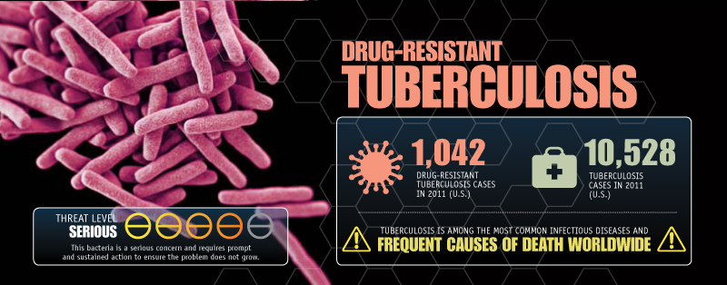 Drug-Resistant Tuberculosis image
