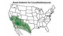 Valley fever fungus (Coccidioides) US exposure map 