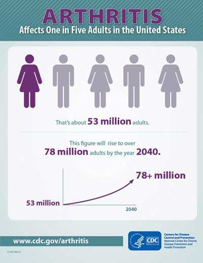 	Infographic: Arthritis affects on in five adults in the United States. Thats about 53 million adults. This figure will rise to over 78 million adults by the year 2040.