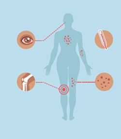 Graphic of human body silhouette showing representations of red eye, joint pain, a rash, and a thermometer to show fever