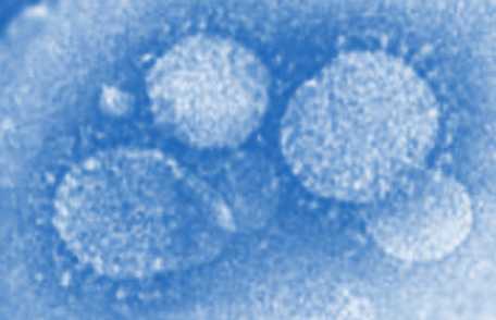 Photo: MERS-CoV particles as seen by negative stain electron microscopy. Virions contain characteristic club-like projections emanating from the viral membrane.