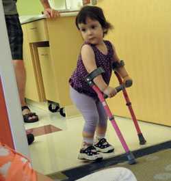 Girl with spina bifida walking