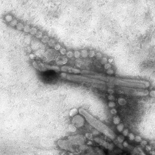 Electron Micrograph Images of H7N9 Virus from China