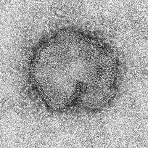 Imágenes de micrografía de electrones del virus H7N9 de China