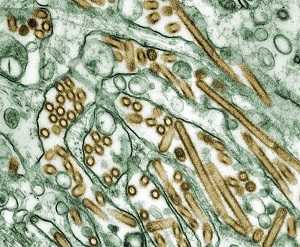 Avian influenza A viruses do not normally infect people, but sporadic infections in people have occurred with some avian influenza A viruses.
