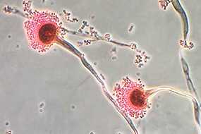 Microscopy of Aspergillus Fumigatus