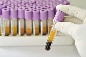 Test tubes for diagnosing blastomycosis