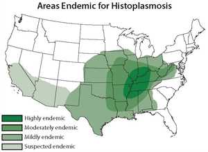 Histoplasma capsulatum: Areas of Endemic for Histoplasmosis