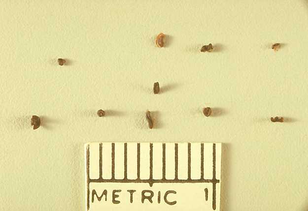 Various sized grains of the fungus Madurella grisea